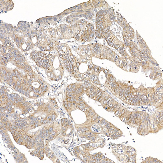 MUTA Rabbit monoclonal antibody