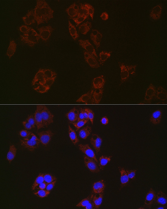 MUTA Rabbit monoclonal antibody