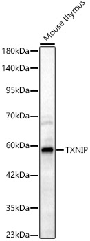 TXNIP Rabbit polyclonal antibody