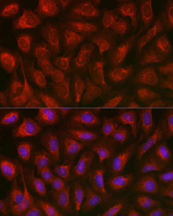 TXNIP Rabbit polyclonal antibody