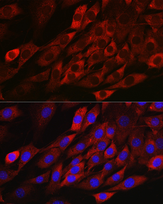 TXNIP Rabbit polyclonal antibody