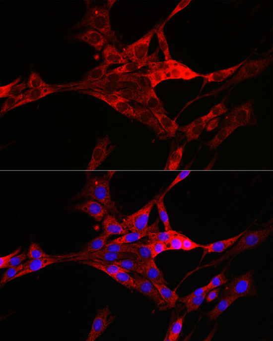 TXNIP Rabbit polyclonal antibody
