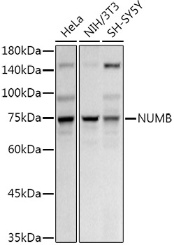 NUMB Rabbit polyclonal antibody