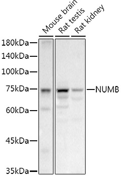 NUMB Rabbit polyclonal antibody