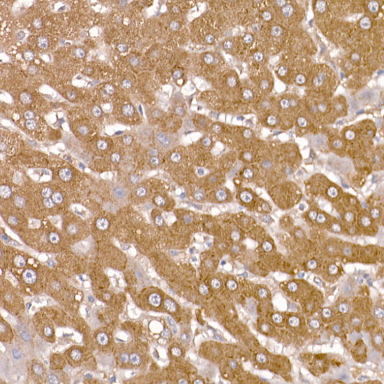 NUMB Rabbit polyclonal antibody