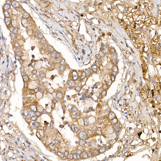NUMB Rabbit polyclonal antibody
