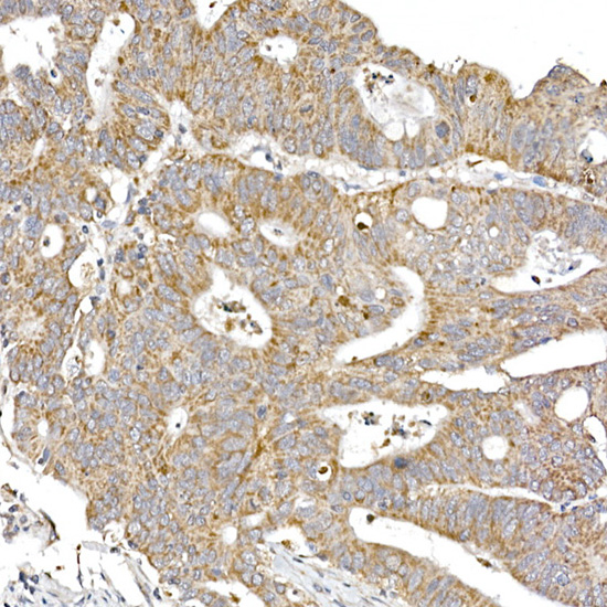 SAMM50 Rabbit monoclonal antibody