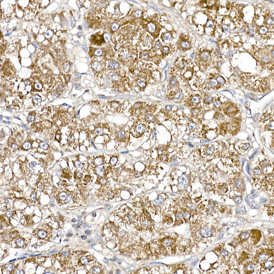 SAMM50 Rabbit monoclonal antibody