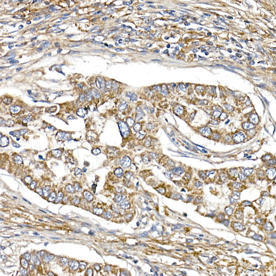 SAMM50 Rabbit monoclonal antibody