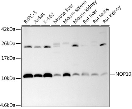 NOP10 Rabbit monoclonal antibody