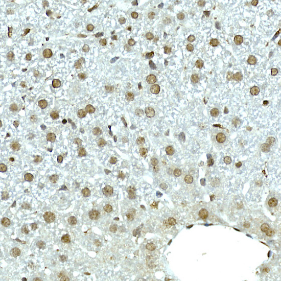 NOP10 Rabbit monoclonal antibody