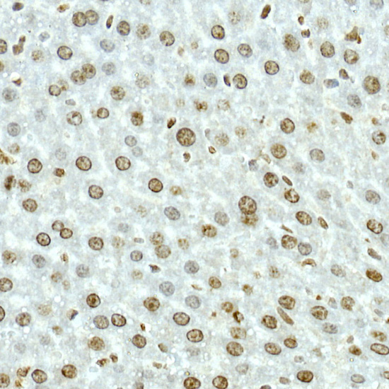 NOP10 Rabbit monoclonal antibody