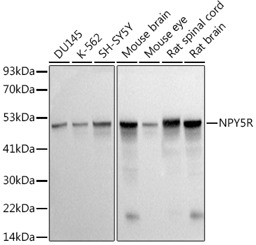 NPY5R Rabbit monoclonal antibody