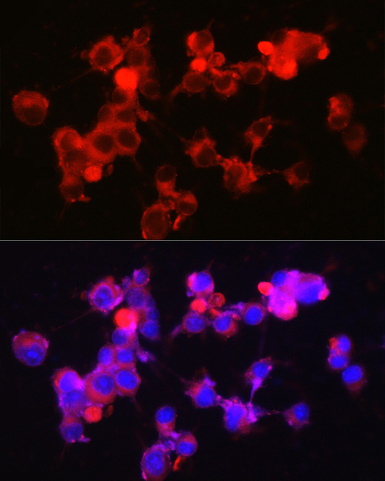 NPY5R Rabbit monoclonal antibody