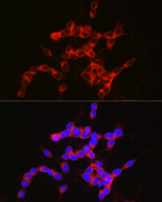 NPY5R Rabbit monoclonal antibody