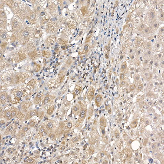 DCAF7 Rabbit monoclonal antibody