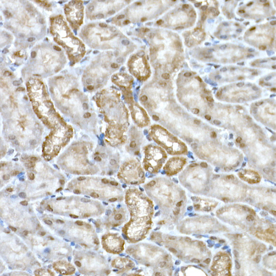 DCAF7 Rabbit monoclonal antibody