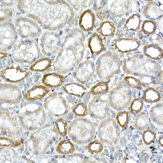DCAF7 Rabbit monoclonal antibody