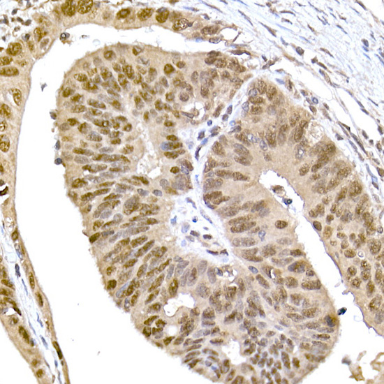 SR protein repeat Rabbit monoclonal antibody