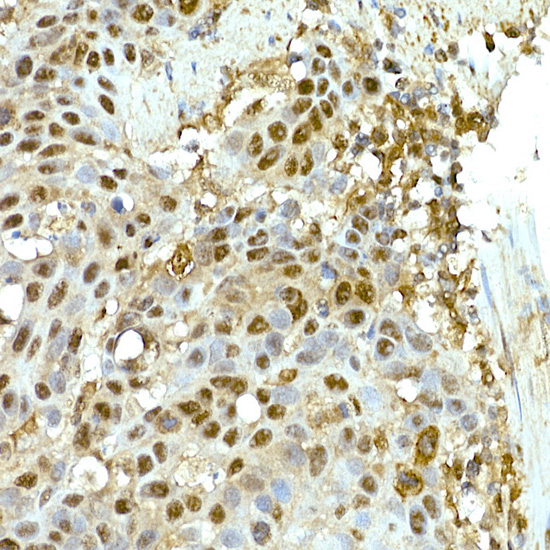 SR protein repeat Rabbit monoclonal antibody
