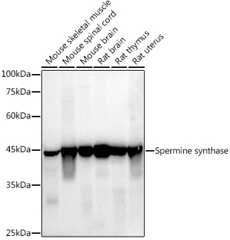 Spermine synthase Rabbit monoclonal antibody