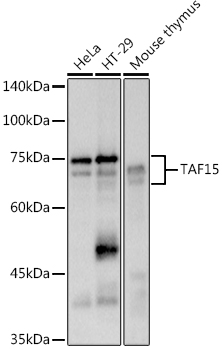 TAF15 Rabbit monoclonal antibody