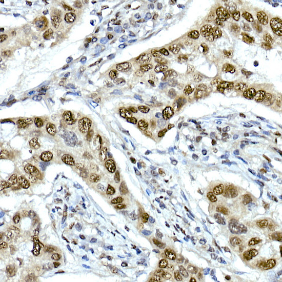 TAF15 Rabbit monoclonal antibody