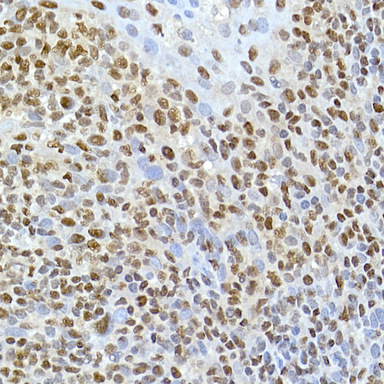 TAF15 Rabbit monoclonal antibody