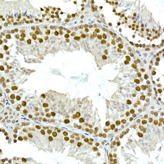 TAF15 Rabbit monoclonal antibody