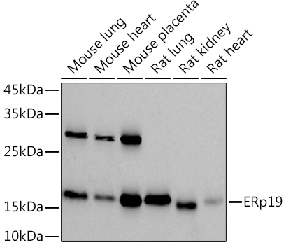 ERp19 Rabbit monoclonal antibody