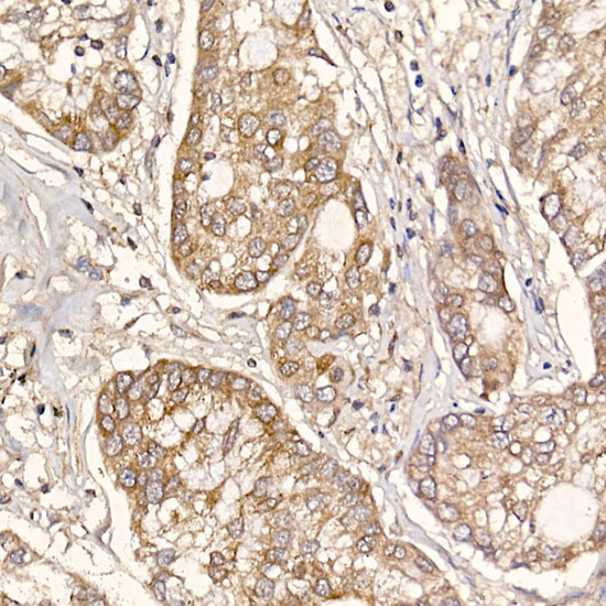 ERp19 Rabbit monoclonal antibody