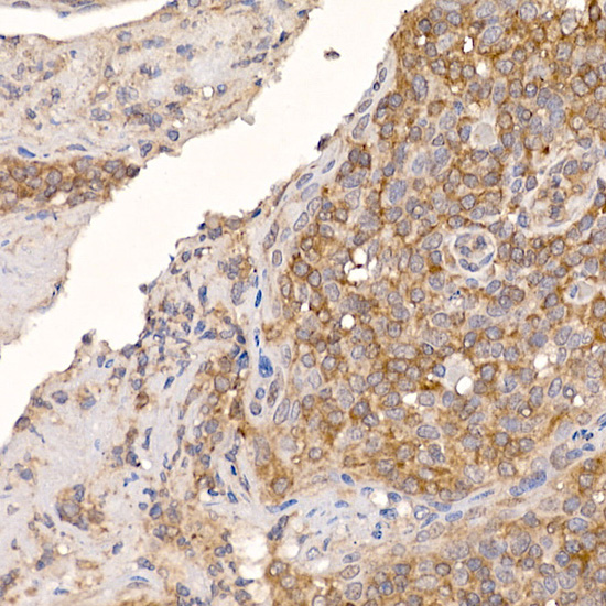 ERp19 Rabbit monoclonal antibody