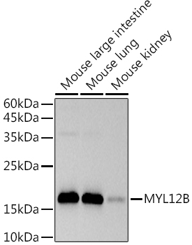 MYL12B Rabbit monoclonal antibody