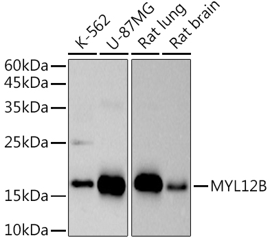 MYL12B Rabbit monoclonal antibody