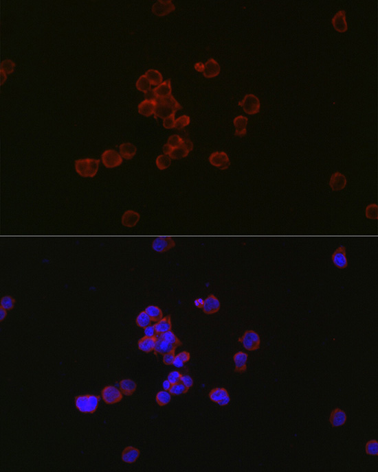 MYL12B Rabbit monoclonal antibody