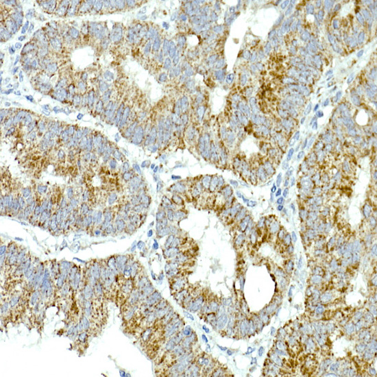 MRPS15 Rabbit monoclonal antibody