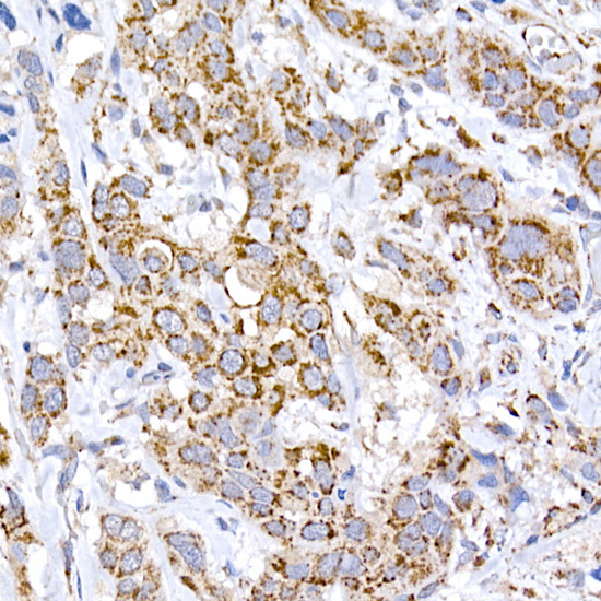 MRPS15 Rabbit monoclonal antibody