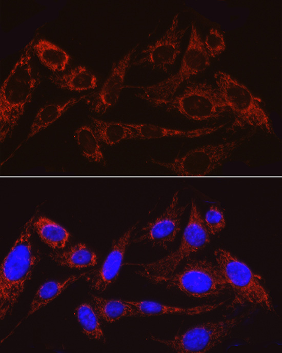 MRPS15 Rabbit monoclonal antibody