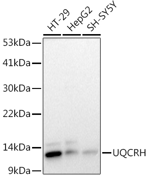 UQCRH Rabbit monoclonal antibody