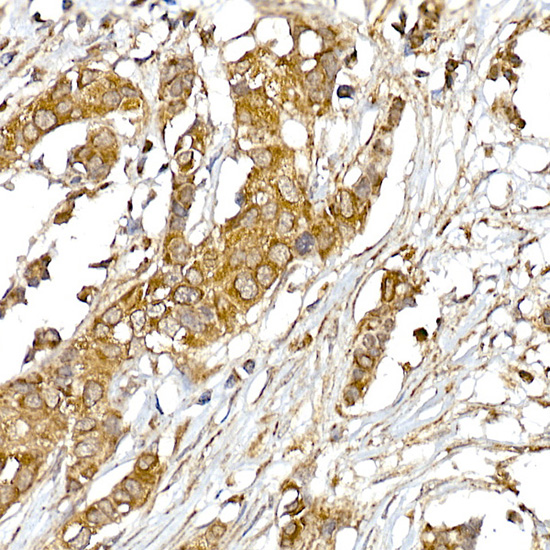 UQCRH Rabbit monoclonal antibody
