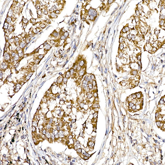 UQCRH Rabbit monoclonal antibody