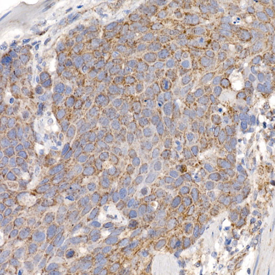 MMUT Rabbit monoclonal antibody