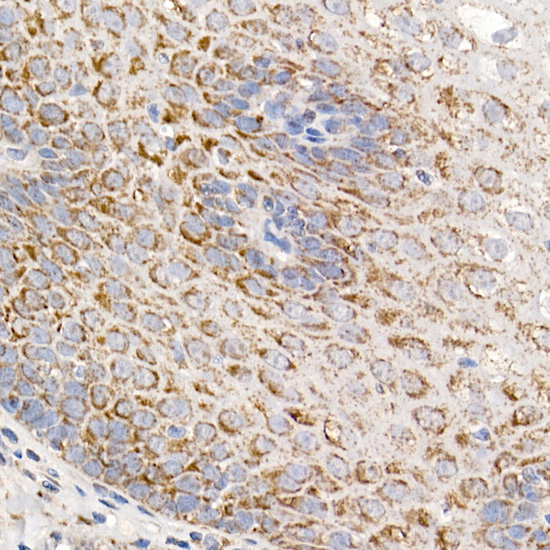 MMUT Rabbit monoclonal antibody