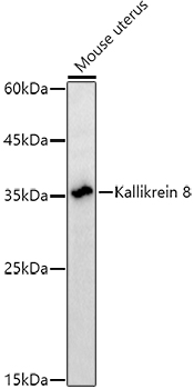 Kallikrein 8 Rabbit monoclonal antibody
