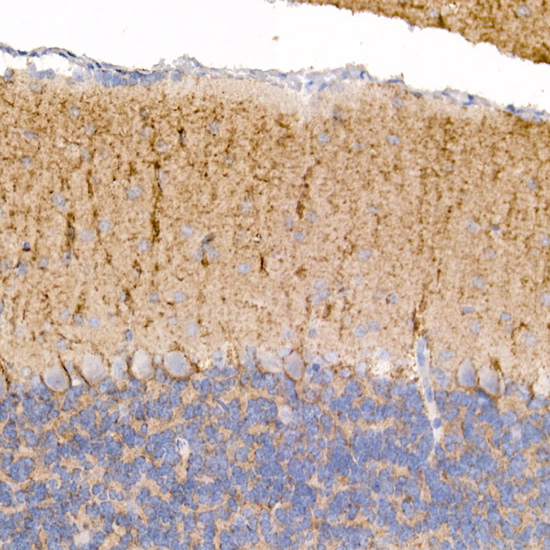 Kallikrein 8 Rabbit monoclonal antibody