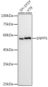 ENPP5 Rabbit monoclonal antibody