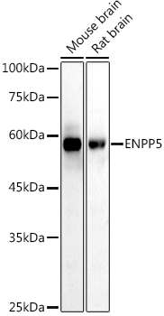 ENPP5 Rabbit monoclonal antibody