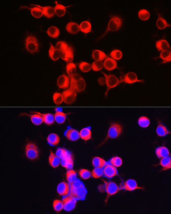 ENPP5 Rabbit monoclonal antibody
