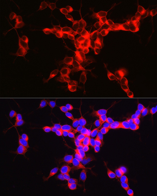 ENPP5 Rabbit monoclonal antibody