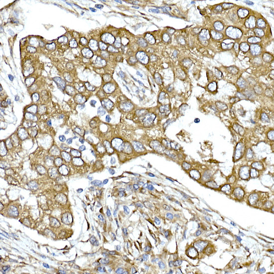 Calumenin Rabbit monoclonal antibody